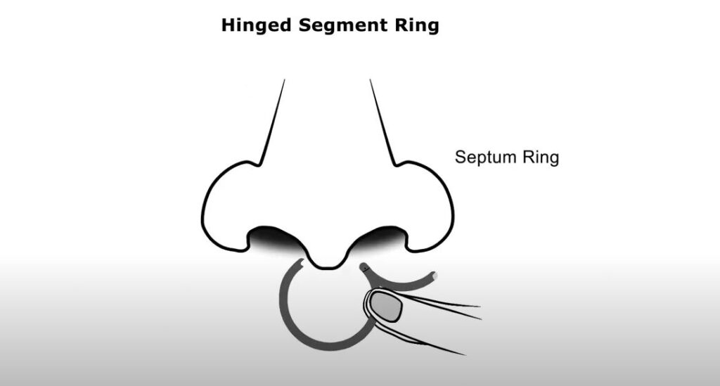 septum